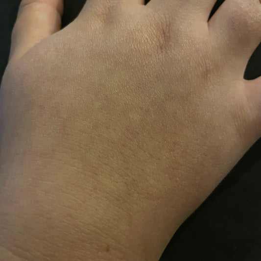 How can i prevent my skin from aging?