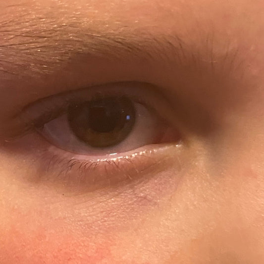 When it comes to undereye circles and puffiness, which eye cream do you recommend?
