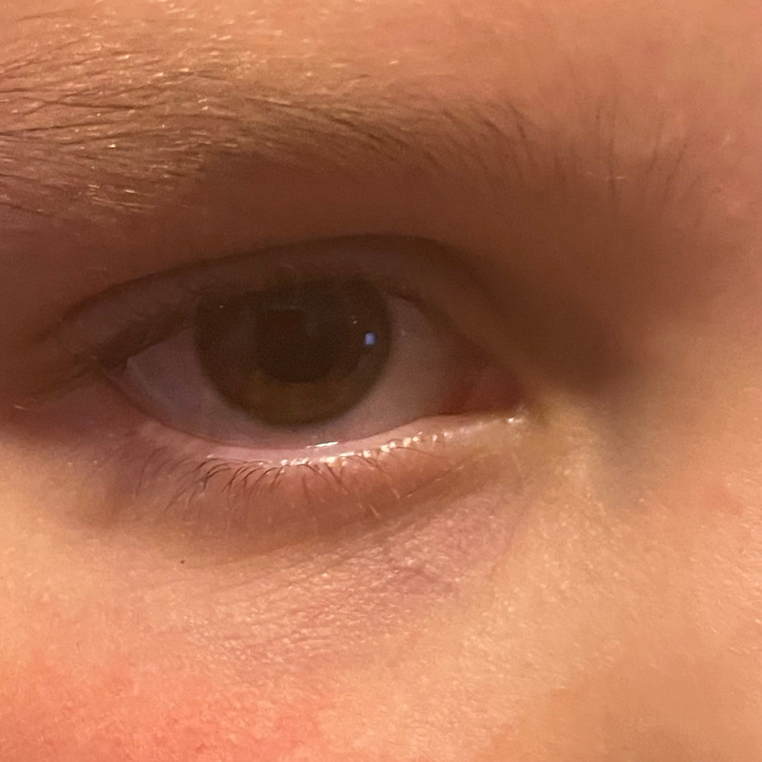 When it comes to undereye circles and puffiness, which eye cream do you recommend?